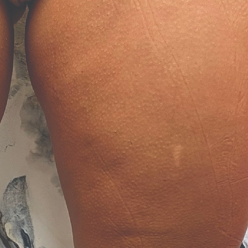 Close-up of skin texture and contours.