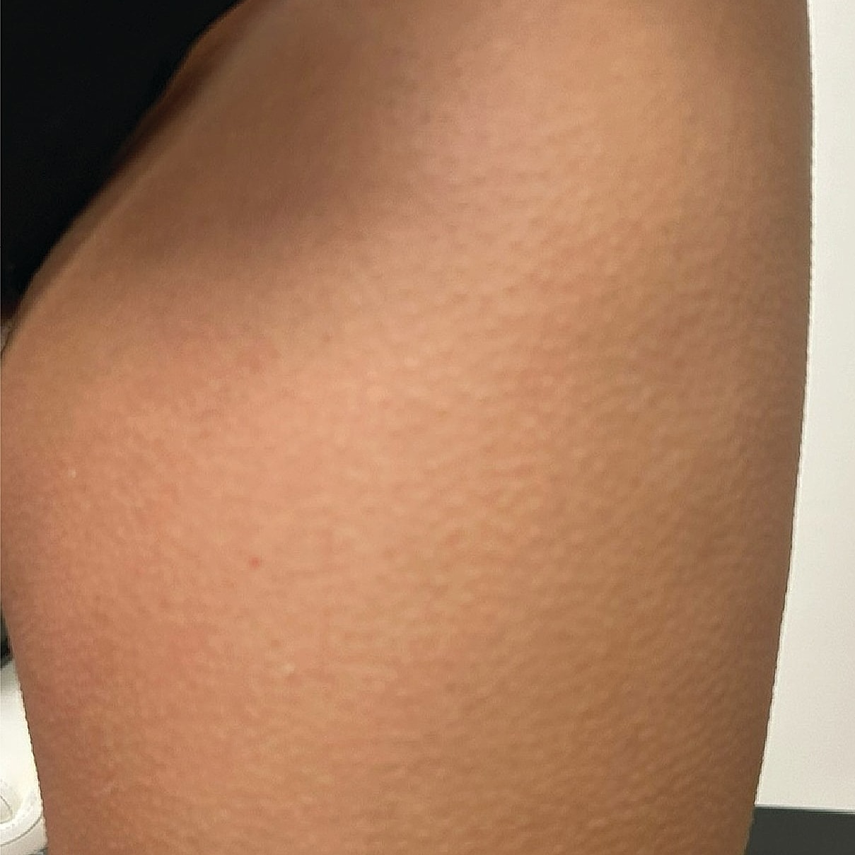 Close-up of smooth, unblemished skin surface.